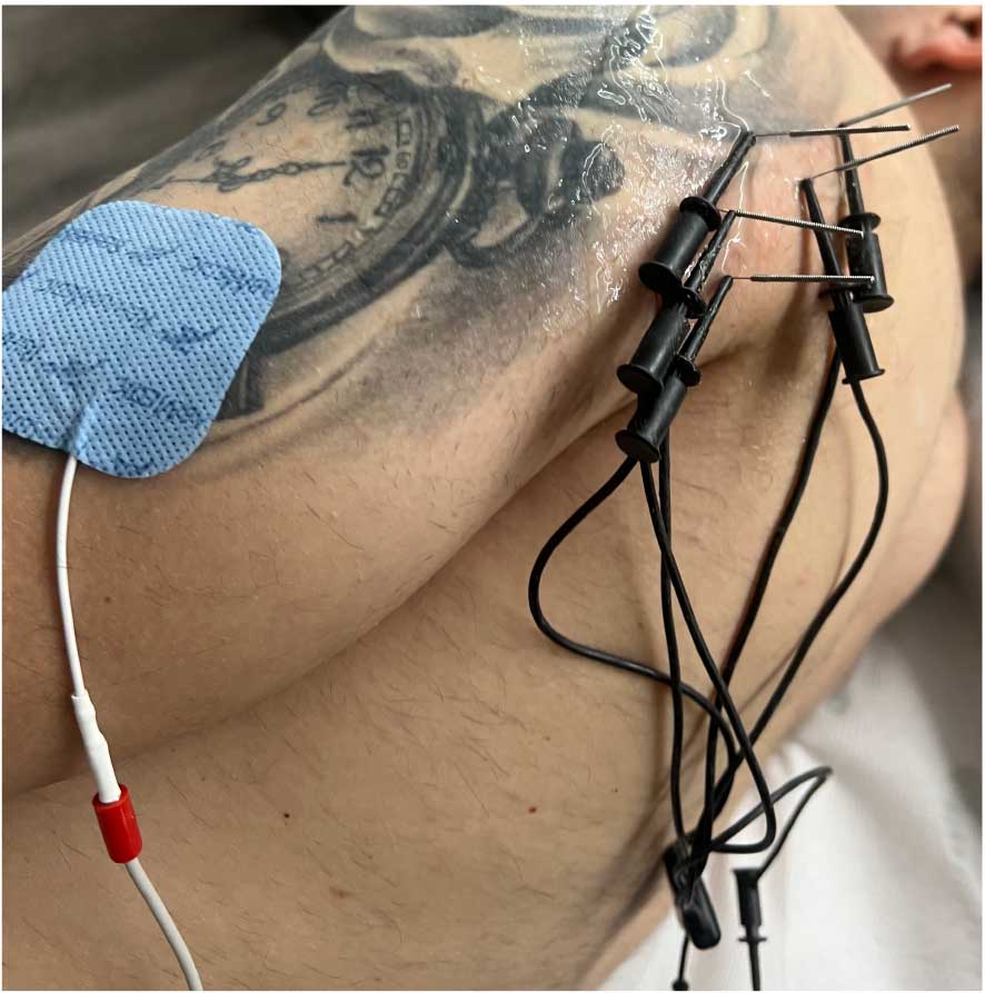 Atmos Fisioterapia